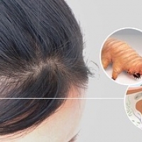 What does hair loss mean? ðŸ§