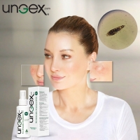 Red Skin Syndrome Vs Rosacea