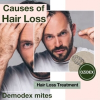 Cause of hair loss