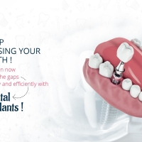 Dental Clinic in Kukatpally