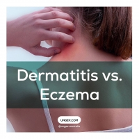 Dermatitis vs. Eczema