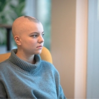 Can Alopecia Universalis be Cured? ðŸ¤”