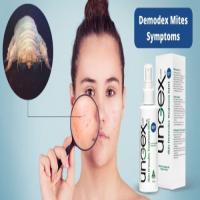 Demodex Mites Symptoms